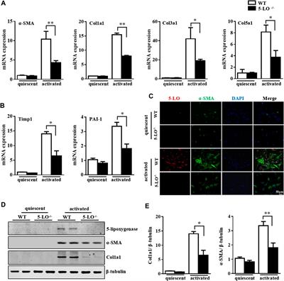 Inhibition of 5-Lipoxygenase in Hepatic Stellate Cells Alleviates Liver Fibrosis